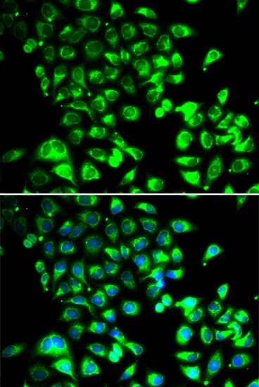 PathPlus™ SSBP1 / mtSSB Antibody