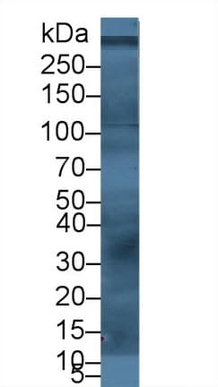 VWF / Von Willebrand Factor Antibody (aa49-230)