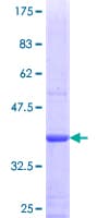 Human PODN Protein (Recombinant GST, N-terminus)