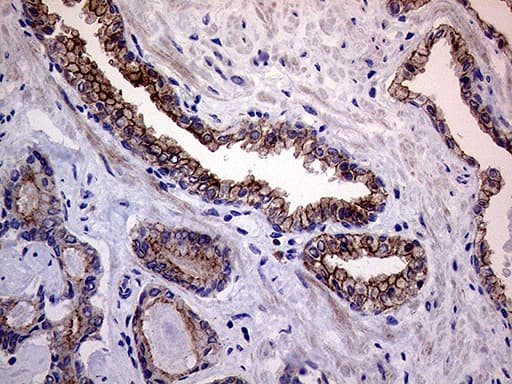 MLPH / Melanophilin Antibody (aa295-600, clone OTI6E3)