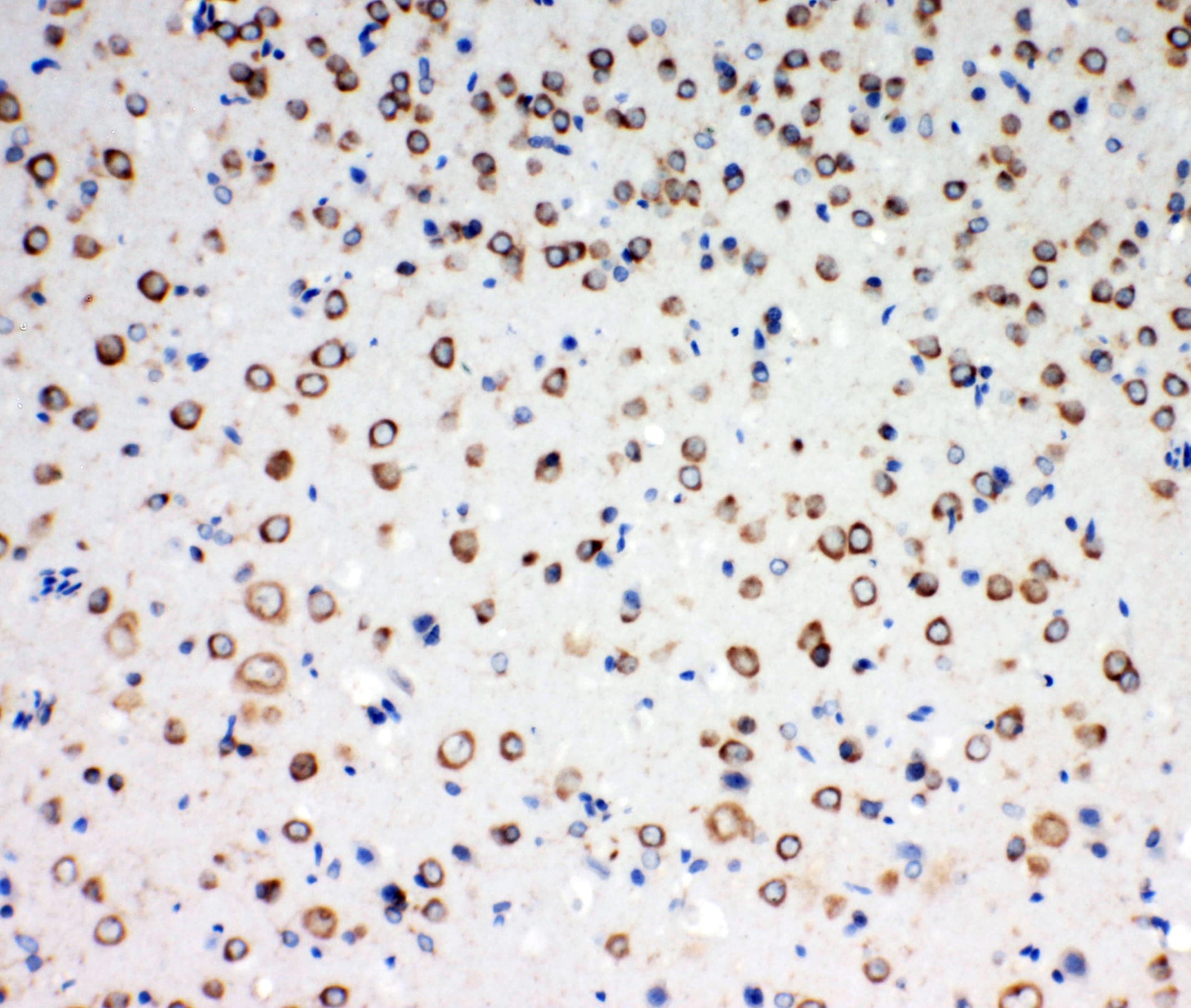 NTRK3 / TRKC Antibody (aa172-186)
