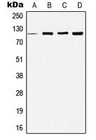 HDAC5 Antibody (Internal)
