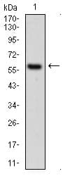 KRT5 / CK5 / Cytokeratin 5 Antibody (aa316-590, clone 10C11E6)