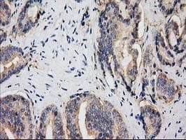 HDAC6 Antibody (clone OTI3E7)