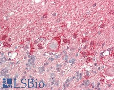 PathPlus™ PARK2 / Parkin 2 Antibody