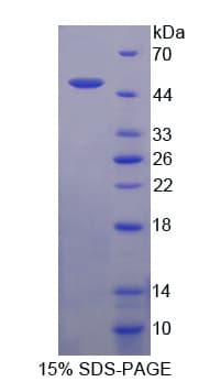 Bovine PI16 Protein (Recombinant His-T7)