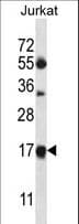 MRPL41 / PIG3 / BMRP Antibody (aa8-36)