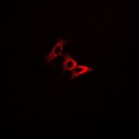 PDXK / PNK Antibody