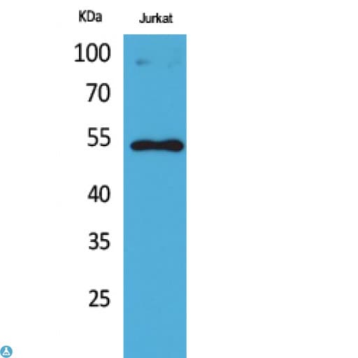 TP53 / p53 Antibody