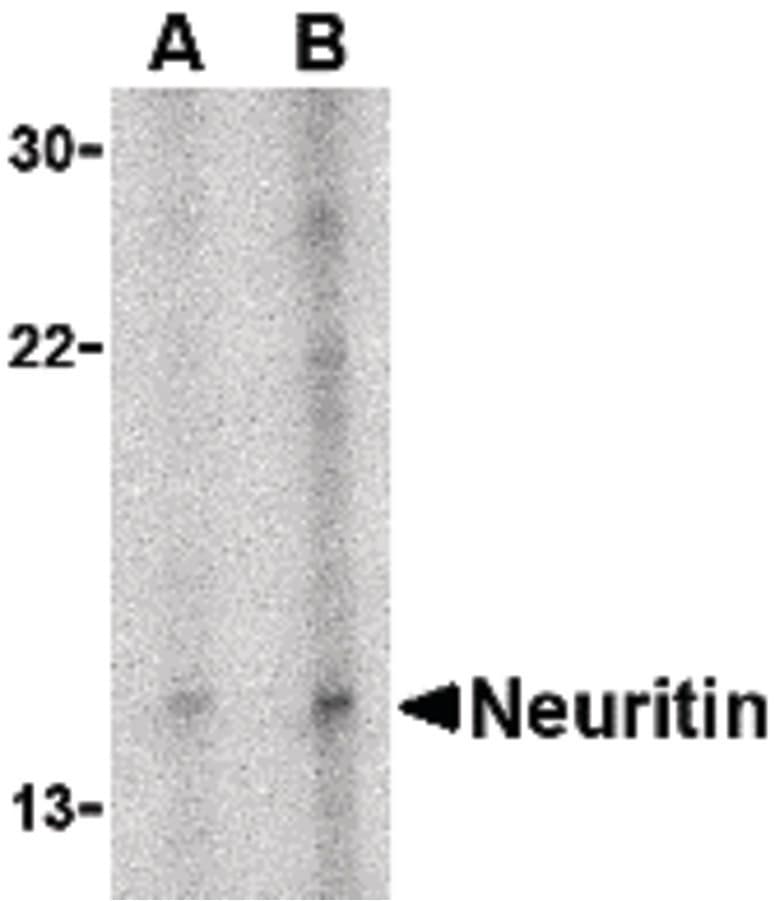 PathPlus™ Polyclonal Rabbit anti-Human NRN1 / Neuritin Antibody (IHC, IF, WB)