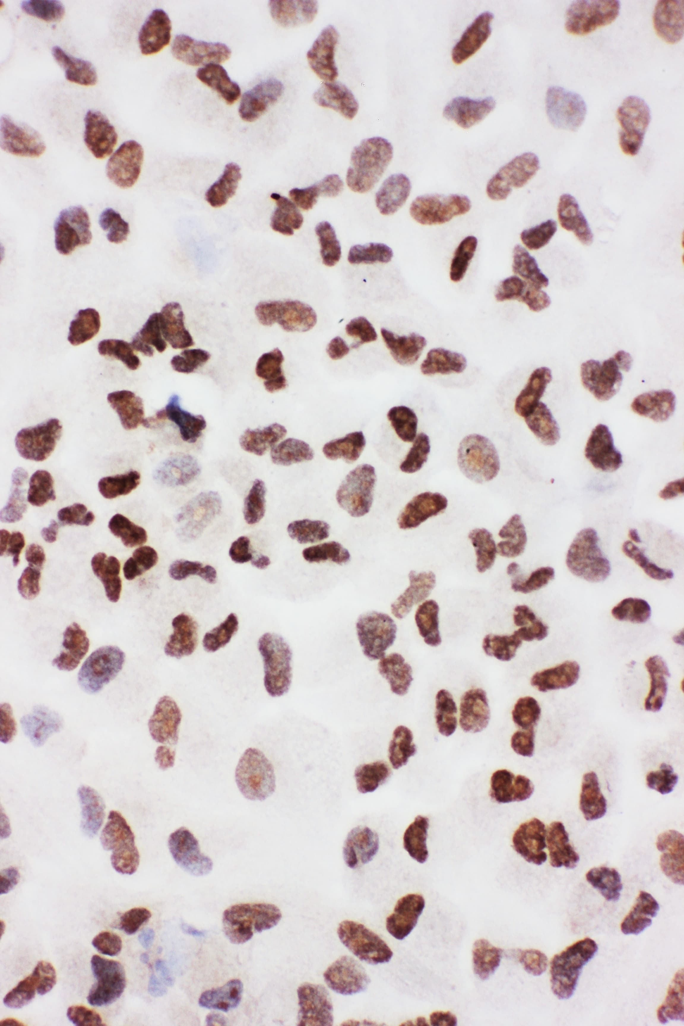 XRCC6 / Ku70 Antibody (aa530-545)
