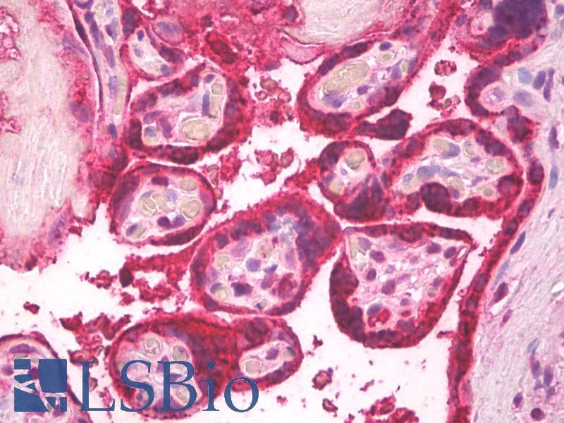IHC-plus™ Polyclonal Sheep anti-Human LHB / Luteinizing Hormone Antibody (IHC)