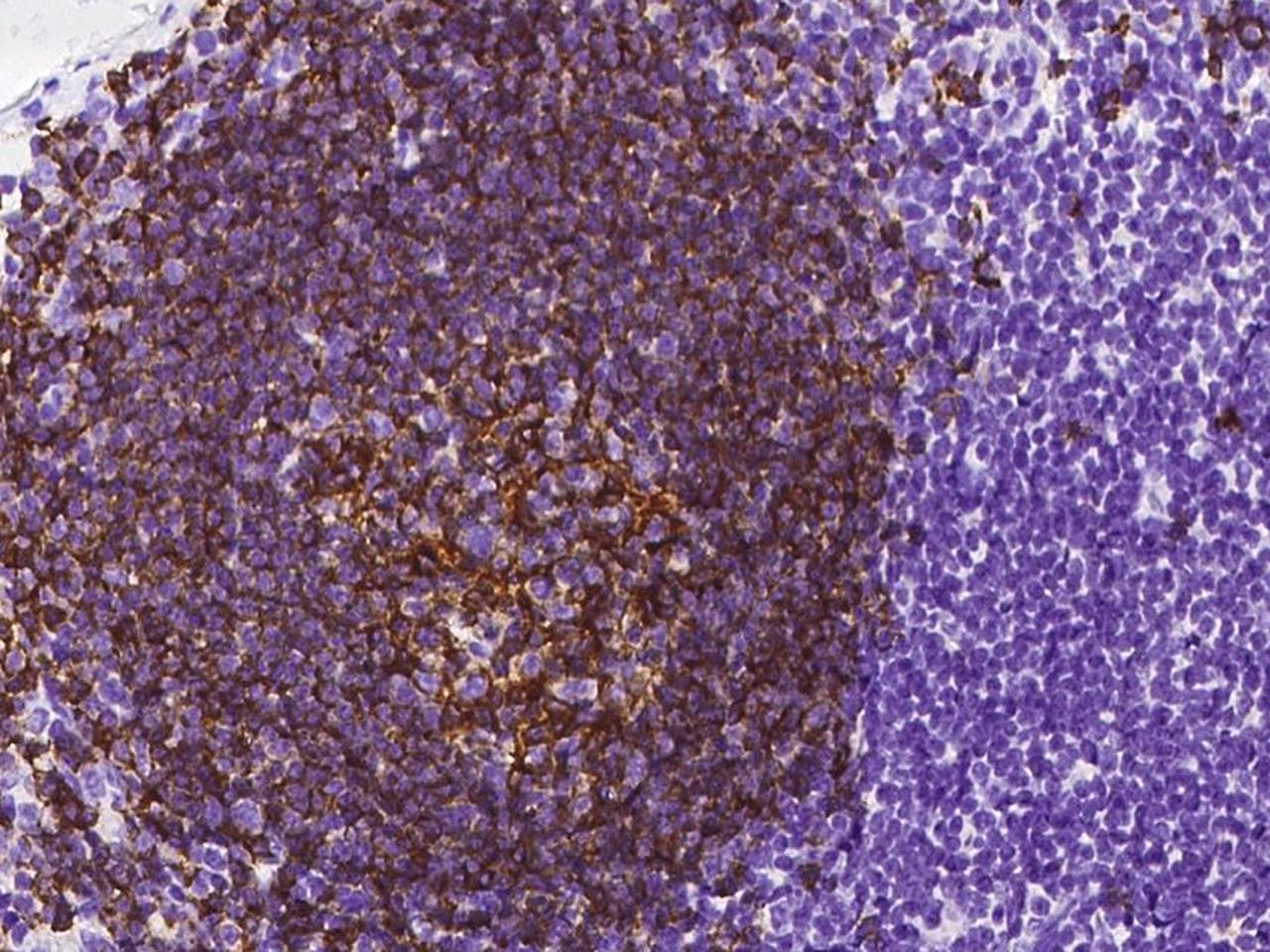 Monoclonal Mouse anti-Human CD20 Antibody (clone 06, Preservative Free, IHC)