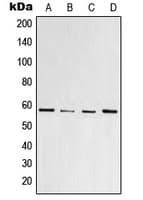 PPARG / PPAR Gamma Antibody (phospho-Ser112)