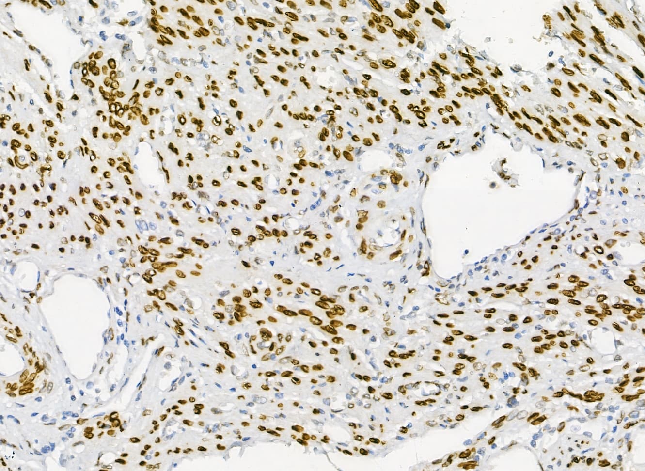 Polyclonal Rabbit anti-Human EMD / Emerin Antibody (IHC, WB)