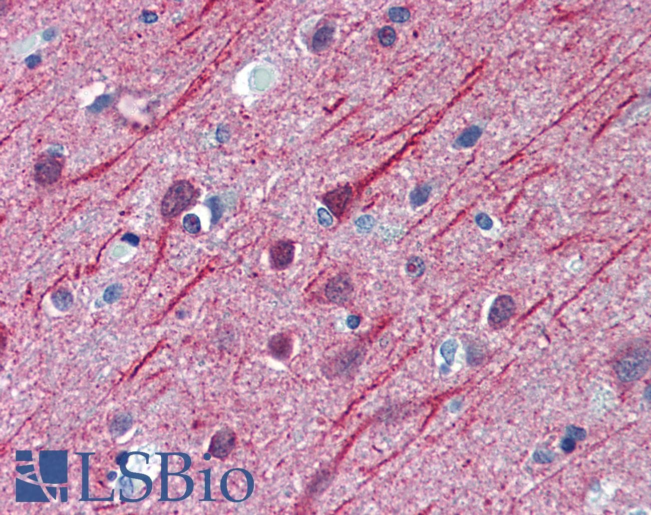 IHC-plus™ Monoclonal Mouse anti-Human TUBB2A / Tubulin Beta 2A Antibody (clone 3F9, IHC, IF, WB)