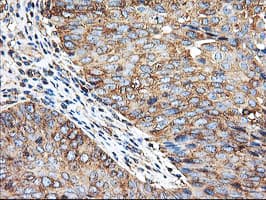 TUBAL3 Antibody (aa150-446, clone OTI1G6, Carrier-free)