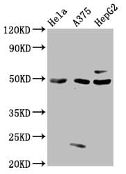 IHC-plus™ STK24 / MST3 Antibody