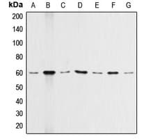 Polyclonal Rabbit anti-Human AKT1 Antibody (N-Terminus, IHC, WB)