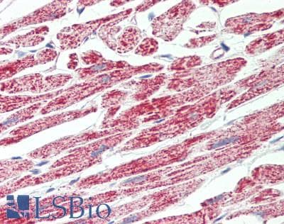 IHC-plus™ Polyclonal Goat anti-Human ATP5F1 Antibody (aa142-153, IHC, WB)