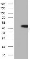 Monoclonal Mouse anti-Human HP / Haptoglobin Antibody (clone OTI2B11, WB)