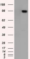 APP / Beta Amyloid Precursor Antibody (clone OTI5C5)