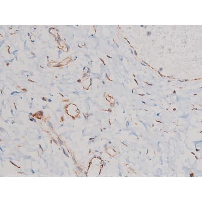 Polyclonal Rabbit anti-Human CDC25A Antibody (phospho-Ser124, IHC, IF, WB)