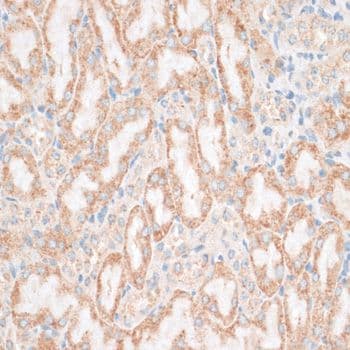HMGIY / HMGA1 Antibody