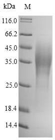 Yersinia pestis caf1 / F1 Capsule Antigen Protein (Recombinant 6His, N-terminus)