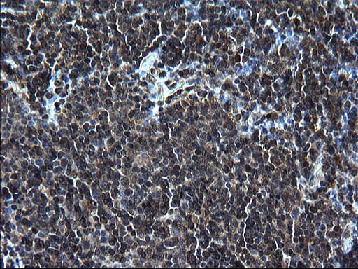 ZFAND3 / TEX27 Antibody (clone OTI1H9)