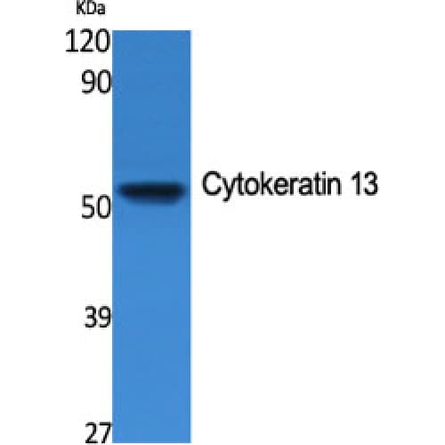 Polyclonal Rabbit anti-Human KRT13 / CK13 / Cytokeratin 13 Antibody (Internal, IHC, WB)