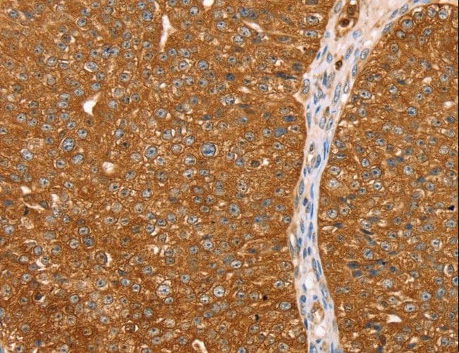 ABCC8 / SUR1 Antibody