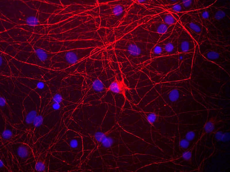 NEFM / NF-M Antibody