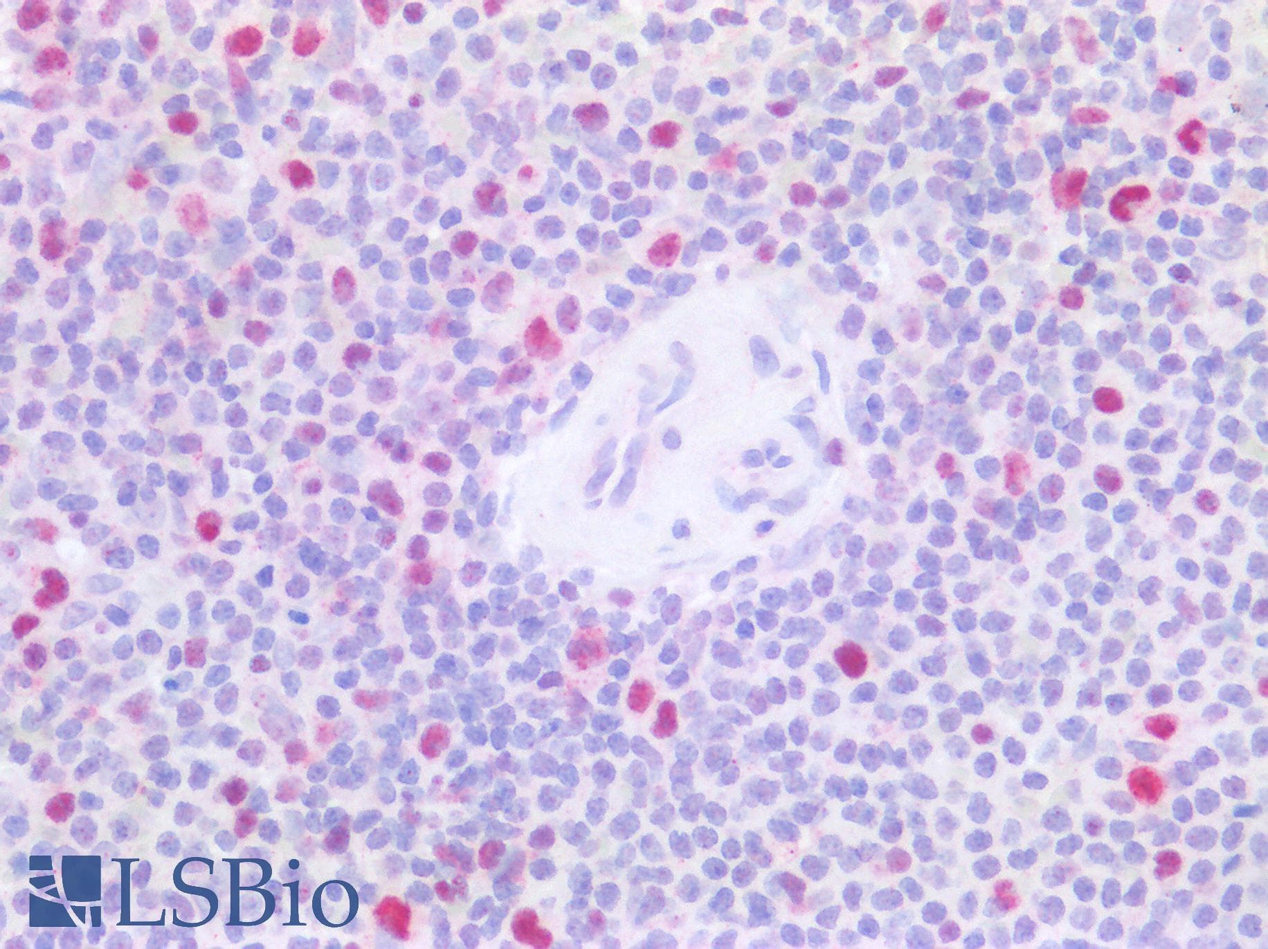PathPlus™ MCM3 Antibody