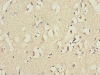 Polyclonal Rabbit anti-Human MID1 Antibody (IHC)