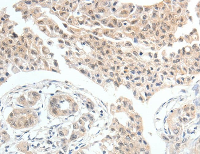 MDK / Midkine Antibody