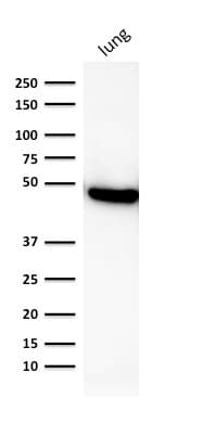 KRT19 / CK19 / Cytokeratin 19 Antibody (clone rKRT19/800, Azide-free, Carrier-free)