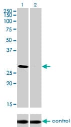 BP1 / DLX4 Antibody (clone 1F11)