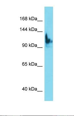 SKIDA1 / C10orf140 Antibody (C-Terminus)