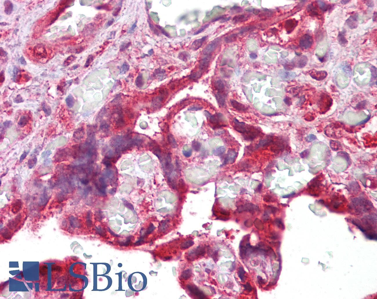 IHC-plus™ Monoclonal Mouse anti-Human CDK6 Antibody (IHC, WB)