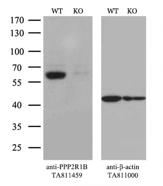 Monoclonal Mouse anti-Human PPP2R1B Antibody (clone OTI8C5, aa19-601, WB)