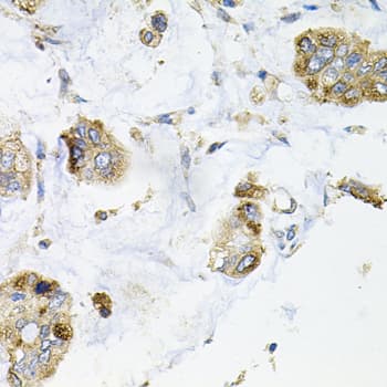GALC / Galactocerebrosidase Antibody