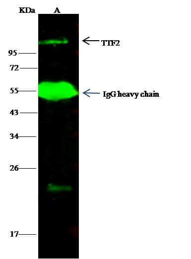 Polyclonal Rabbit anti-Human TTF2 / HuF2 Antibody (Preservative Free, WB)