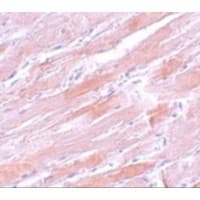 Polyclonal Rabbit anti-Human IDH2 Antibody (IHC, IF, WB)