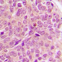 PAK1 + PAK2 + PAK3 Antibody (C-Terminus)