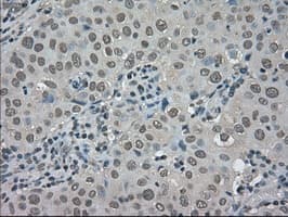 TRIB2 Antibody (clone OTI8D11)