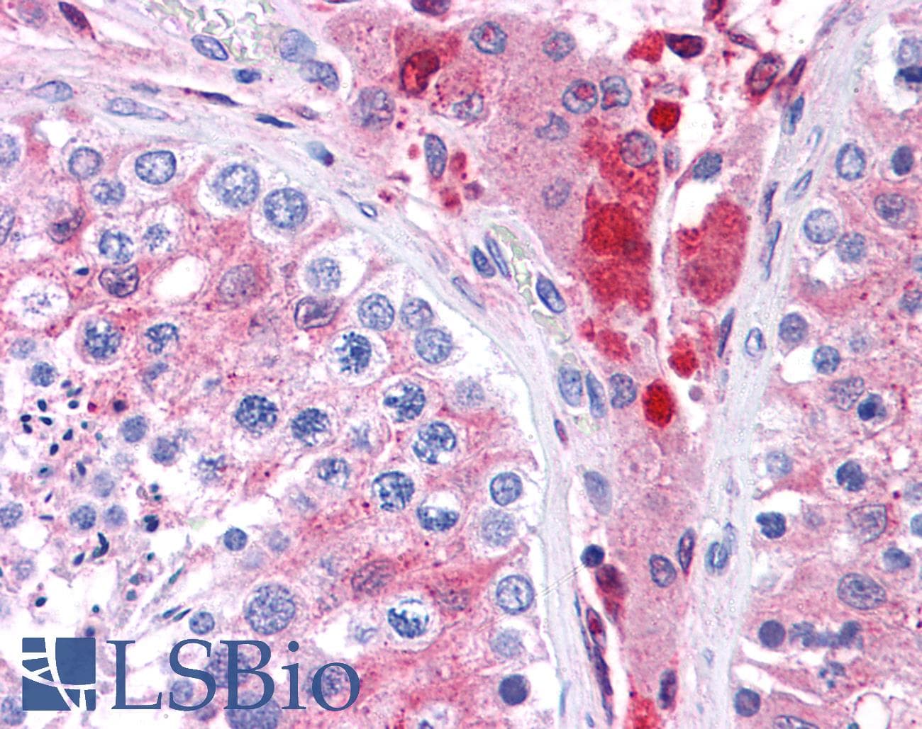 GSTM1 Antibody (C-Terminus)