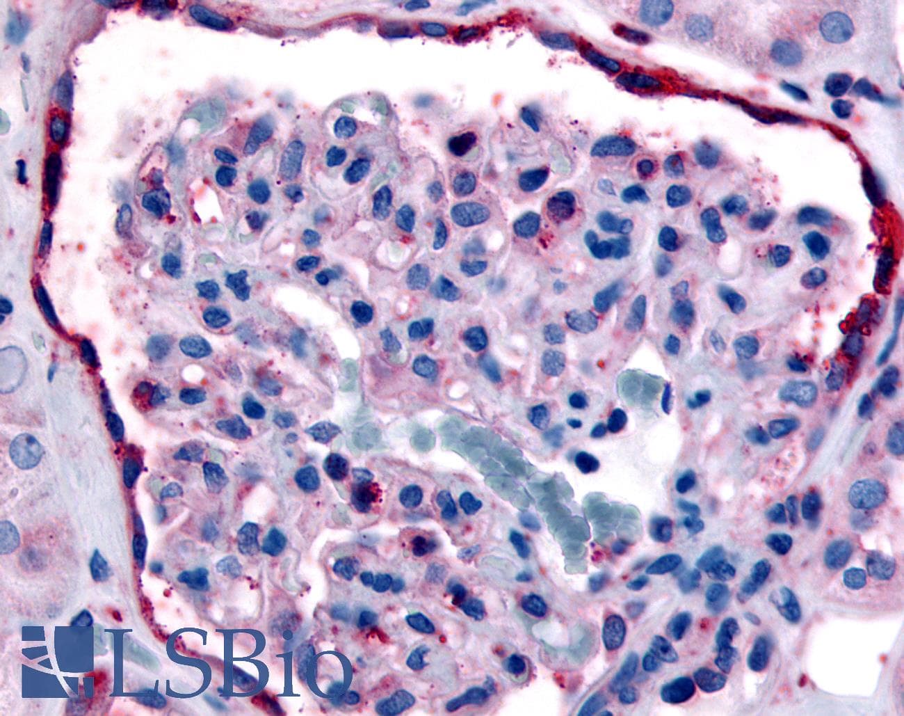 IHC-plus™ ERBB4 / HER4 Antibody (Internal)