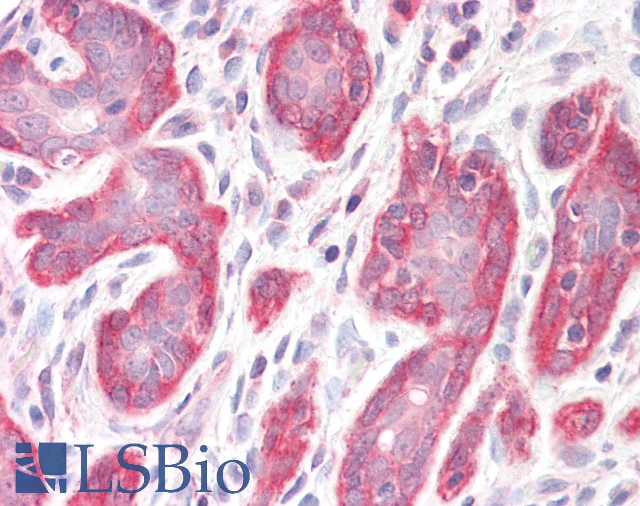 IHC-plus™ PDLIM4 / RIL Antibody (aa317-330)