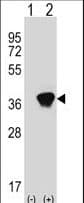 AKR1A1 Antibody (aa293-325)